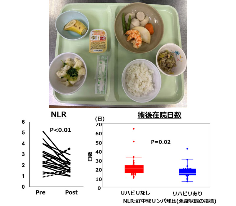 食事指導とNLR・術後在院日数グラフ