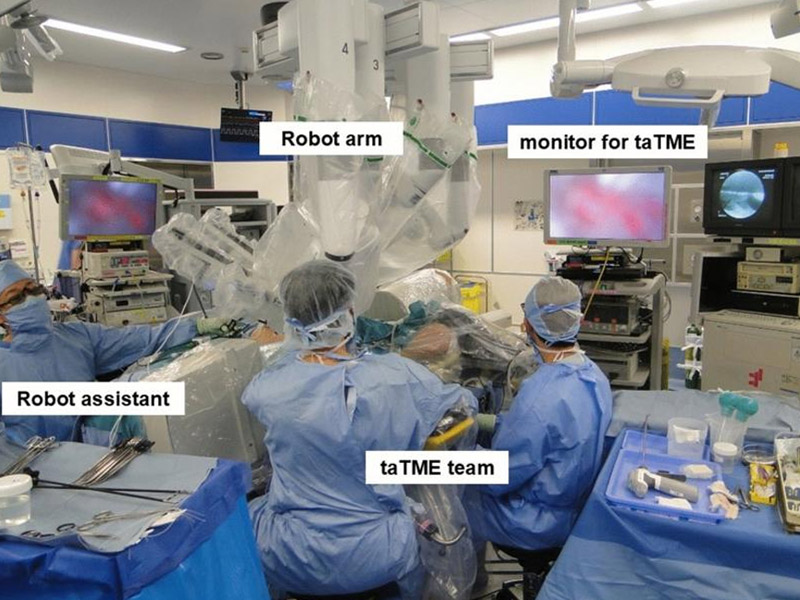 ロボット＋TaTME 手術室
